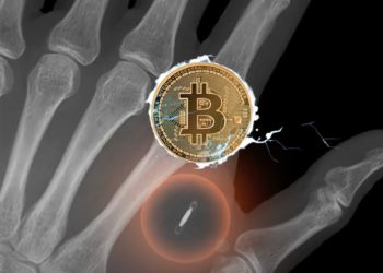 閃電網路人體錢包！瑞士狂粉在手掌植入晶片，刷手完成BTC支付