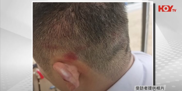 想出金就打？JPEX用戶「遭黑衣人圍毆」：1月起無法提款、叫我去香港面交