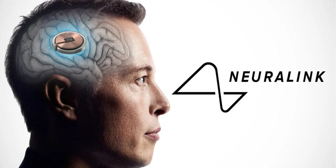 馬斯克宣布：腦機介面Neuralink「人腦植入晶片」手術成功！首例病患恢復良好
