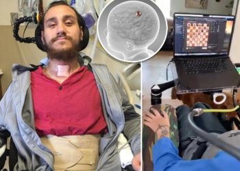 Neuralink晶片植入人腦》馬斯克：癱瘓者可用意念玩文明帝國、下旗